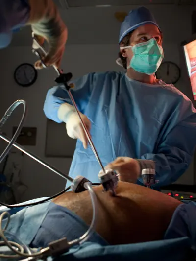 Doctores en quirofano realizando una cirugia laparoscopica